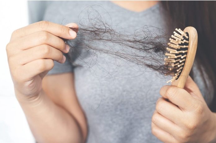 Alopecia femenina: una condición que afectará a una de cada cuatro mujeres en algún momento de su vida