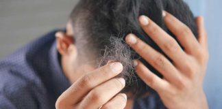 ¡Chile ocupa el Top 3 en el ranking de calvicie en Latinoamérica! Causas y cómo prevenir la caída del cabello