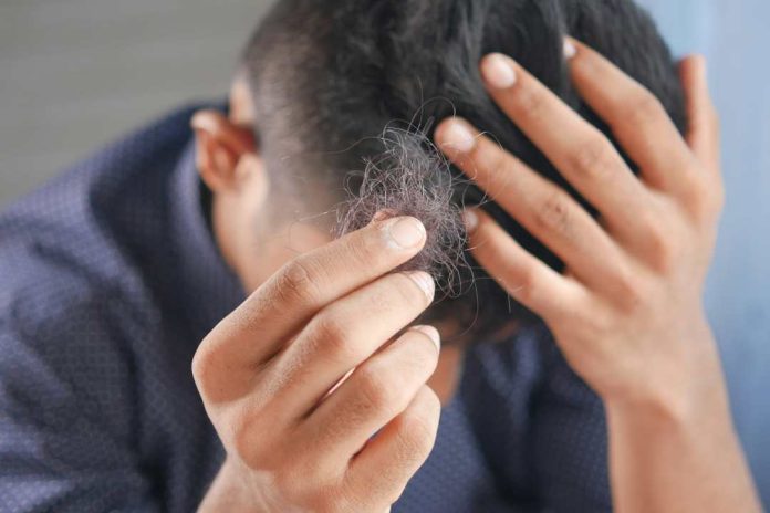 ¡Chile ocupa el Top 3 en el ranking de calvicie en Latinoamérica! Causas y cómo prevenir la caída del cabello