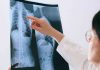 Hernia Discal Lumbar: La importancia del diagnóstico temprano y la cirugía oportuna