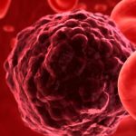 Día Mundial del Cáncer: innovadores tratamientos para mieloma múltiple son más eficaces y mejoran la calidad de vida de los pacientes