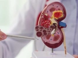 Día Mundial del Riñón: La importancia de una logística eficiente en salud Día Mundial del Riñón: La importancia de una logística eficiente en salud