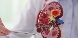 Día Mundial del Riñón: La importancia de una logística eficiente en salud