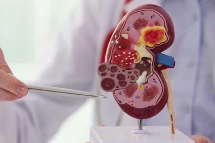 Día Mundial del Riñón La importancia de una logística eficiente en salud Día Mundial del Riñón: La importancia de una logística eficiente en salud