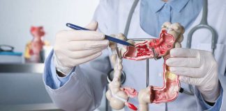 El desafío creciente del cáncer colorrectal en Chile