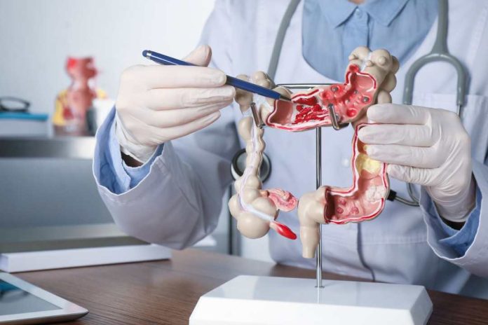 El desafío creciente del cáncer colorrectal en Chile