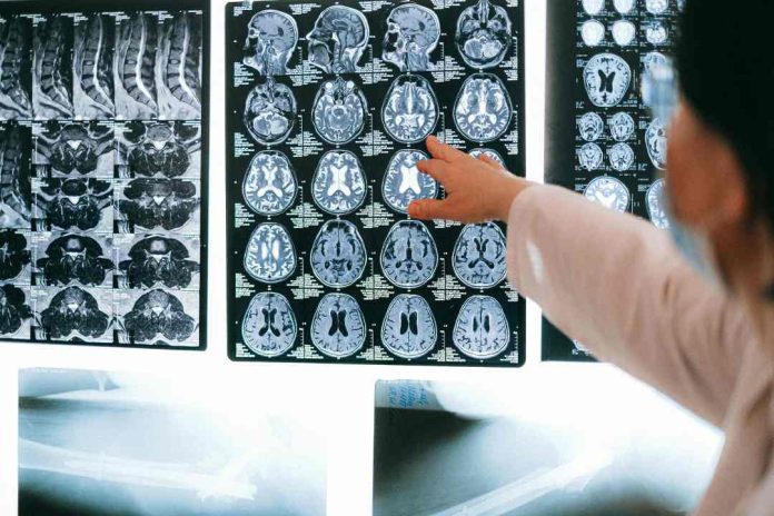 En 22% creció la incidencia de accidentes cerebrovasculares en 2024 en clínicas chilenas