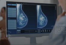 Inteligencia Artificial: una herramienta clave para la detección temprana del cáncer de mama en Chile Inteligencia Artificial: una herramienta clave para la detección temprana del cáncer de mama en Chile
