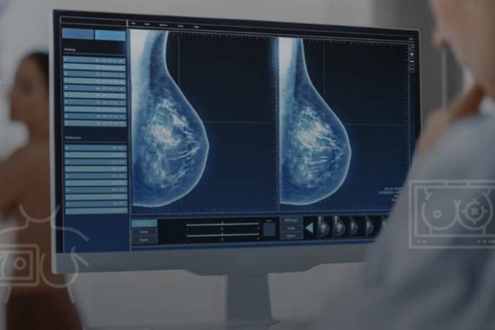 Inteligencia Artificial una herramienta clave para la detección temprana del cáncer de mama en Chile Inteligencia Artificial: una herramienta clave para la detección temprana del cáncer de mama en Chile