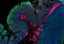 Investigadores de Mayo Clinic identifican proteínas relacionadas con la resistencia a la inmunoterapia en el cáncer colorrectal metastásico Investigadores de Mayo Clinic identifican proteínas relacionadas con la resistencia a la inmunoterapia en el cáncer colorrectal metastásico