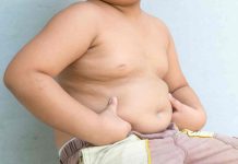 Obesidad: la punta de un iceberg sanitario que urge abordar Obesidad: la punta de un iceberg sanitario que urge abordar