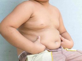 Obesidad: la punta de un iceberg sanitario que urge abordar