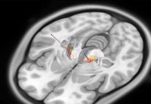 Pensando fuera de la caja: Descubriendo un nuevo enfoque para el monitoreo de ondas cerebrales  Pensando fuera de la caja: Descubriendo un nuevo enfoque para el monitoreo de ondas cerebrales