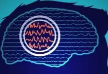 Estudio: La estimulación cerebral profunda personalizada podría tratar la epilepsia resistente a los fármacos