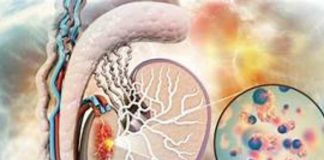 Autoexamen y PET‑CT: dos aliados clave para curar el cáncer testicular