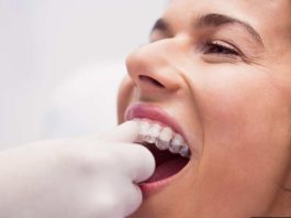 Bruxismo: Una causa de la pérdida de piezas dentales Bruxismo: Una causa de la pérdida de piezas dentales