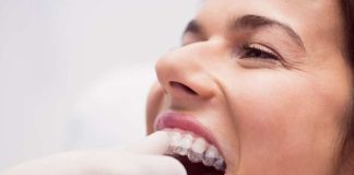 Bruxismo: Una causa de la pérdida de piezas dentales