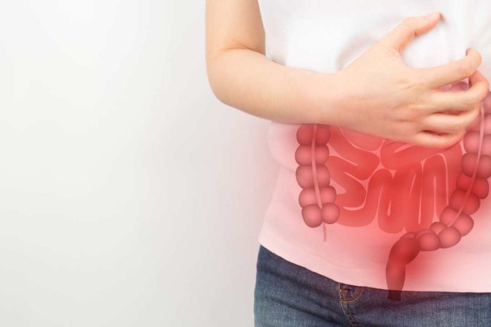 Cáncer Colorrectal una afección con cada vez más incidencia en los adultos jóvenes