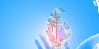 Neuropatía Periférica: cómo identificar sus síntomas y evitar confusiones con otras enfermedades