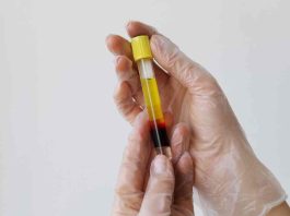 Suero Rico en Factores más Ácido Hialurónico (SRF+): La innovación tecnológica en salud que se abre paso en Chile