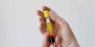 Suero Rico en Factores más Ácido Hialurónico (SRF+): La innovación tecnológica en salud que se abre paso en Chile