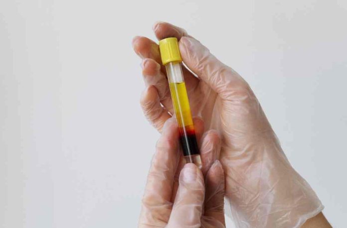 Suero Rico en Factores más Ácido Hialurónico (SRF+): La innovación tecnológica en salud que se abre paso en Chile