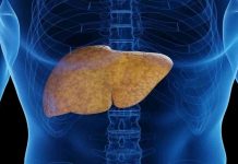 ¡Cuidado con el Hígado Graso! Puede poner en riesgo tu salud ¡Cuidado con el Hígado Graso! Puede poner en riesgo tu salud