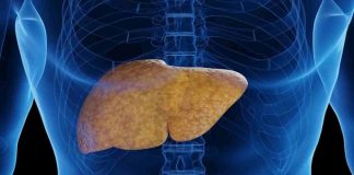 ¡Cuidado con el Hígado Graso! Puede poner en riesgo tu salud