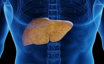 ¡Cuidado con el Hígado Graso! Puede poner en riesgo tu salud ¡Cuidado con el Hígado Graso! Puede poner en riesgo tu salud