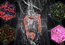 A menudo visto como desecho, las heces pueden proporcionar pistas sobre el papel de la microbiota en el tratamiento del cáncer A menudo visto como desecho, las heces pueden proporcionar pistas sobre el papel de la microbiota en el tratamiento del cáncer