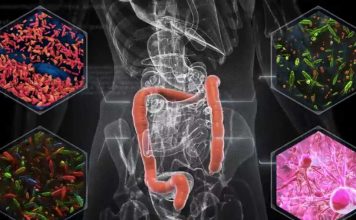 A menudo visto como desecho, las heces pueden proporcionar pistas sobre el papel de la microbiota en el tratamiento del cáncer A menudo visto como desecho, las heces pueden proporcionar pistas sobre el papel de la microbiota en el tratamiento del cáncer