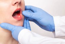 Detectar a tiempo puede salvar vidas: Expertos alertan sobre el cáncer mandibular y sus síntomas más comunes