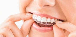 Gracias a la IA tratamientos de brackets invisibles bajan costos y tiempos