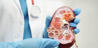 Cáncer de riñón: Advierten incremento de casos por envejecimiento poblacional