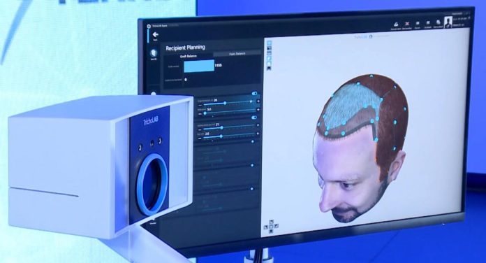 El futuro del tratamiento capilar ya está en Chile, combinando Inteligencia Artificial e innovación para resultados precisos