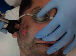 El láser que rejuvenece sin dejar huella ya se aplica en Chile El láser que rejuvenece sin dejar huella ya se aplica en Chile