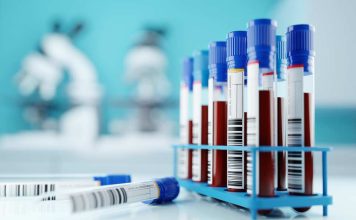 Exámenes claves para detectar trastornos en la sangre y evitar enfermedades como la anemia y leucemia