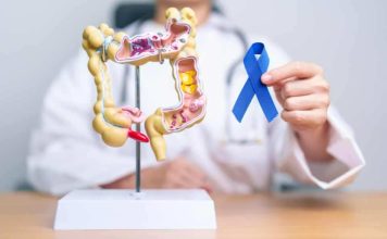 Preocupante alza de cáncer colorrectal en menores de 50 años en Chile: estudio de oncólogo UDD fue presentado en congreso mundial Preocupante alza de cáncer colorrectal en menores de 50 años en Chile: estudio de oncólogo UDD fue presentado en congreso mundial