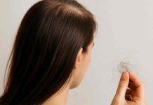 Caída del pelo: un problema que puede ocurrir a cualquier edad Caída del pelo: un problema que puede ocurrir a cualquier edad