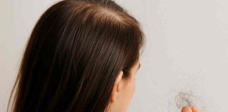 Caída del pelo: un problema que puede ocurrir a cualquier edad