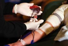 Operarse con tu propia sangre: la alternativa médica que podría revolucionar las cirugías en Chile Operarse con tu propia sangre la alternativa médica que podría revolucionar las cirugías en Chile