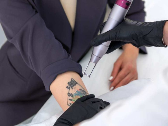 ¿Quieres borrarte un tatuaje?: Especialista entrega consejos y tips para realizarlo de forma segura y efectiva
