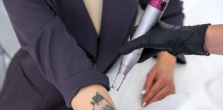 ¿Quieres borrarte un tatuaje?: Especialista entrega consejos y tips para realizarlo de forma segura y efectiva