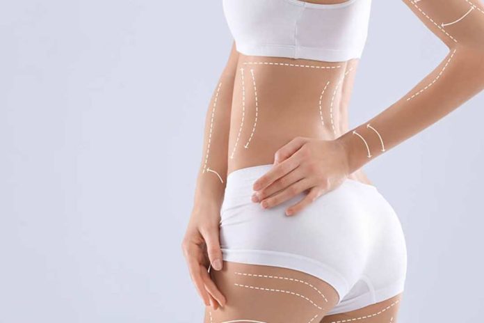 Triple cirugía estética termina en tragedia: el llamado a cuestionar los riesgos reales