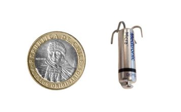 Concepción marca un hito nacional con el implante número 100 del marcapasos más pequeño del mundo Concepción marca un hito nacional con el implante número 100 del marcapasos más pequeño del mundo