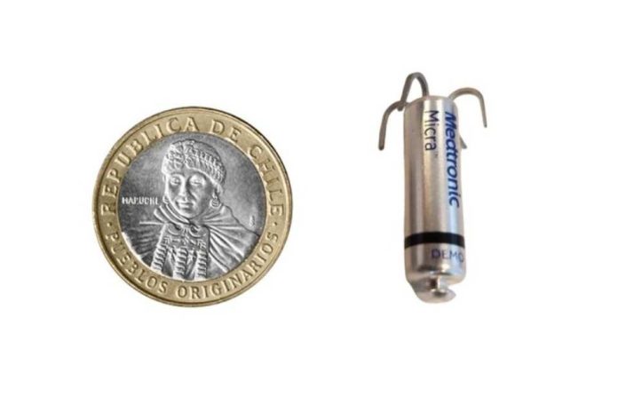 Concepción marca un hito nacional con el implante número 100 del marcapasos más pequeño del mundo