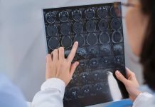 Enfermedades del cerebro: ¿cuáles son las más comunes en Chile? Enfermedades del cerebro: ¿cuáles son las más comunes en Chile?