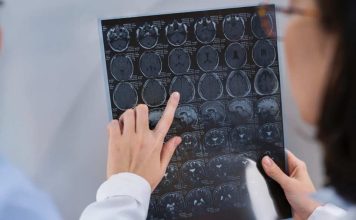 Enfermedades del cerebro: ¿cuáles son las más comunes en Chile? Enfermedades del cerebro: ¿cuáles son las más comunes en Chile?
