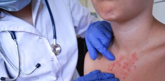 Escarlatina en el contexto escolar