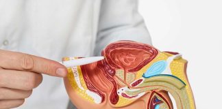 Metformina: beneficios y limitaciones en cáncer de próstata metastásico